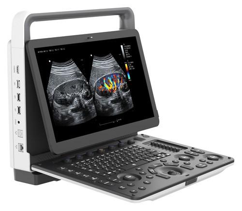 ZONCARE-i50 B&W Ultrasound